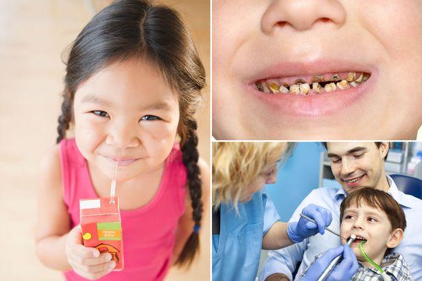 चीनी से बच्चों के दांत खराब होते हैं